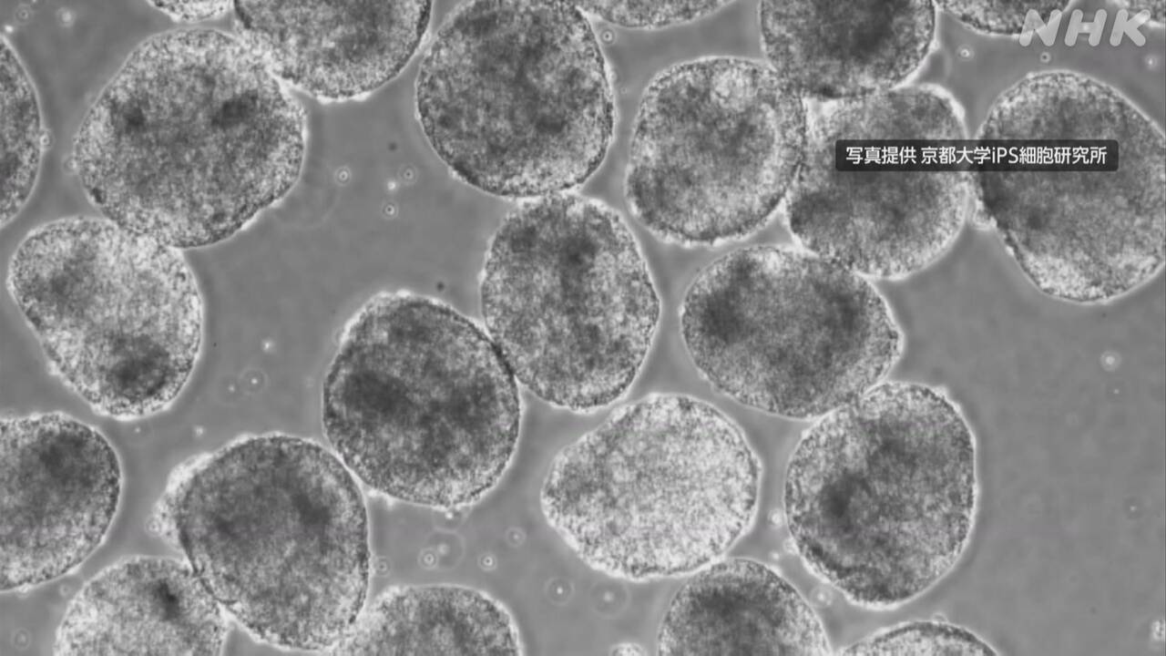 Therapy using iPS cells, approved by experts.