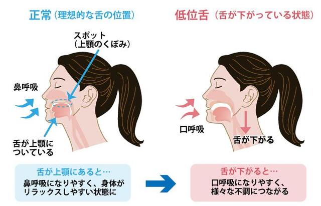 Whole-body care starting from the mouth 1 The tongue is an "invisible postural muscle" that supports breathing, sleep, and facial features [Whole-body care starting from the mouth].