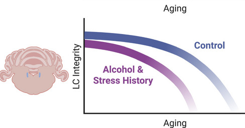 "Drinking due to stress" alters the brain, and even after abstaining, it does not return to normal, leading to a decreased ability to cope with changes in middle age, according to a U.S. team's mouse experiment.