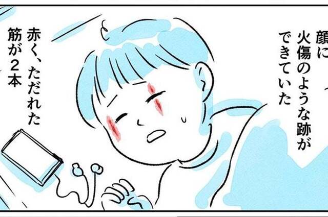 “When I woke up in the morning, I had a burn on my face?” When I asked the doctor... I was shocked by the unexpected truth: “They're everywhere in the country. Scary” “At summer festivals, they cling to the hems of your clothes” (Experience manga)
