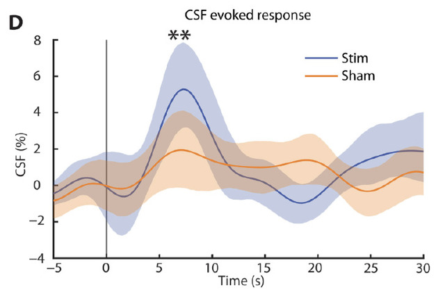 Does hearing "pink noise" during sleep enhance the washing away of "brain waste"? MIT experiments in humans, published in a Science-family journal