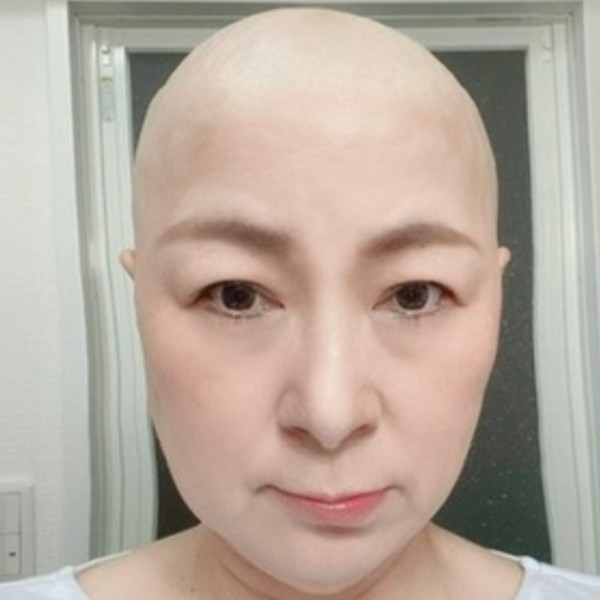 [Fighting illness] A 1.8 cm lump grew to nearly 5 cm in 8 months... Malignant lymphoma, which progresses on a monthly basis