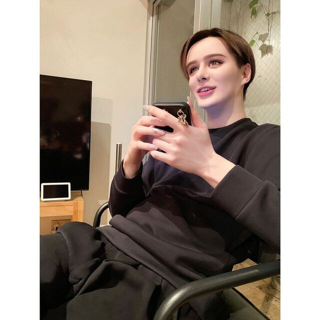 Forehead bulging, chin stretching... 10 million yen on plastic surgery - Matt's "current face" causes a stir: "Wait, it's like this now!?" "It's probably the aesthetic he himself desires" "It's his personal freedom"