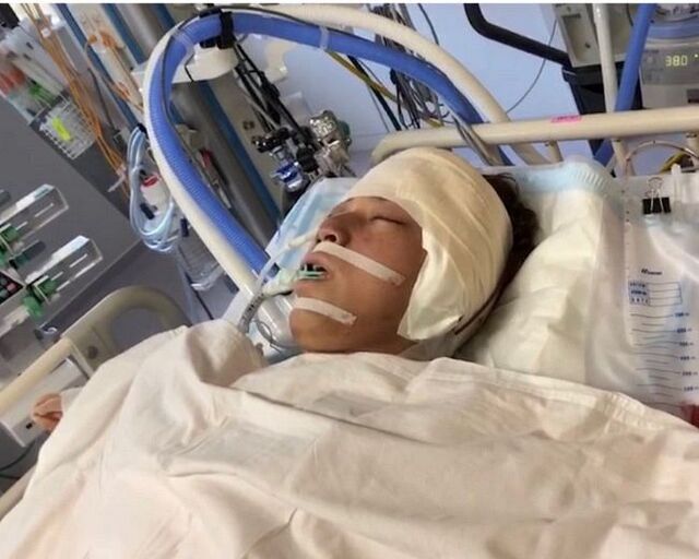 "My favorite actor..." Emergency hospitalization due to cerebral hemorrhage, face deformed by craniotomy... 40-year-old Shota Mase reveals his "current appearance," drawing comments like "That must have been so hard" and "I'm glad your face healed"