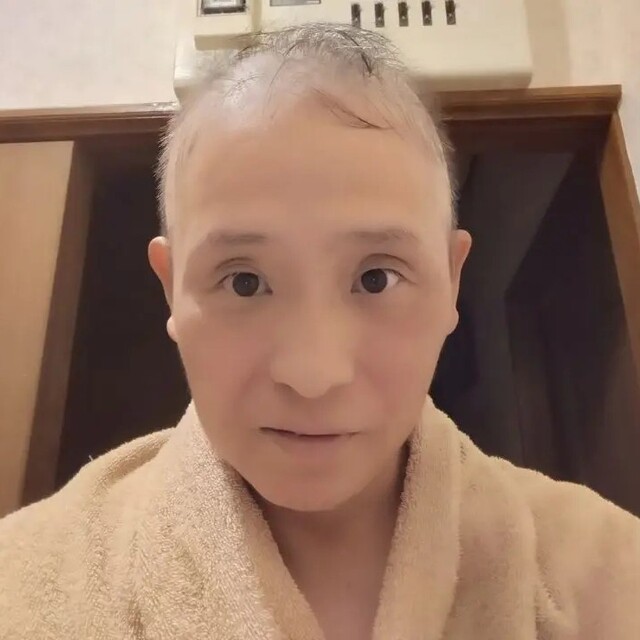 [Fighting Illness] A stomachache that never stopped for 24 hours led to pancreatic cancer, and after surgery, liver metastasis: "It's hard, it hurts, I'm scared"